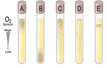 Which of the tubes contains facultative anaerobes? | Homework.Study.com