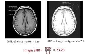 Signal-to-Noise Ratio (SNR) in MRI | Factors affecting SNR