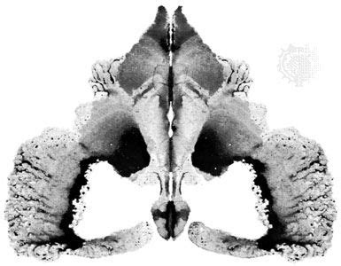 Rorschach test | Definition | Britannica