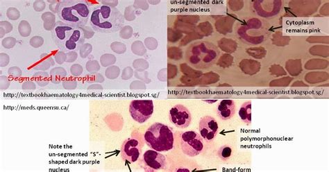 Haematology in a NutShell: Band-Form Neutrophils