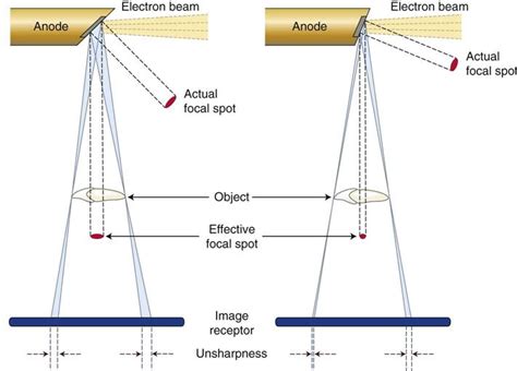 6. Projection Geometry | Pocket Dentistry