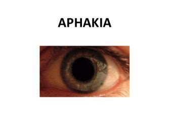 About Aphakia: Symptoms, Causes and Treatments Available