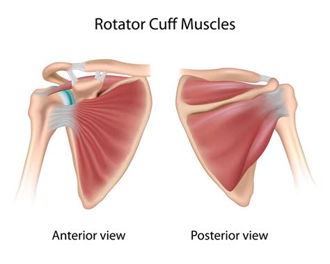 Rotator Cuff Tendonitis | Shoulder Specialist | Austin, Round Rock ...