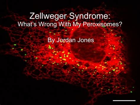 Zellweger Syndrome