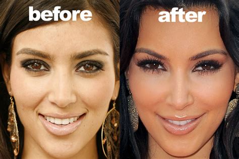 Plastic Surgery Examples: Kim Kardashian plastic surgery before & after 킴 카다시안 성형 수술 전후