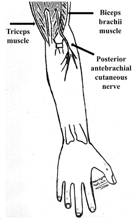 Terminal anatomical course of posterior antebrachial cutaneous nerve... | Download Scientific ...