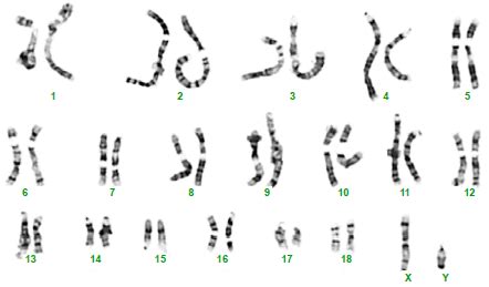 Difference Between Male and Female Karyotypes | Male Karyotypes vs ...