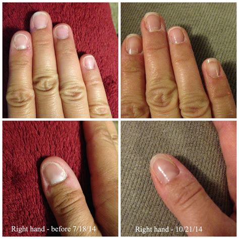 As a perpetual nail biter, I decided to give Jamberry try. The wraps promoted growth in my nail ...