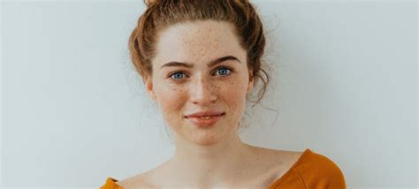 Freckles Vs Sun Spots: What's The Difference?