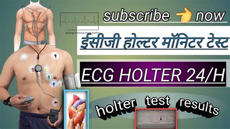 ecg holter monitor test // holter test results // holter monitor 24 ...