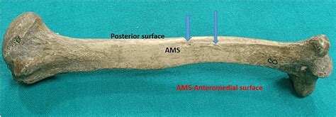 Cureus | Morphometric Study of the Nutrient Foramen of the Humerus in ...