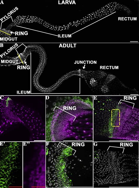 The Drosophila Hindgut Lacks Constitutively Active Adult Stem Cells but ...