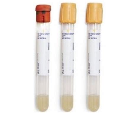 BD Vacutainer SST Tube - Save at Tiger Medical, Inc