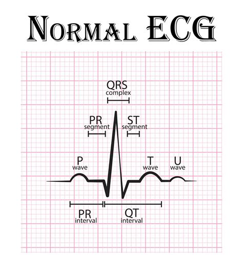 Your Apple Watch Can Now Record Your Ecg – But What Does That Mean And | Free Download Nude ...