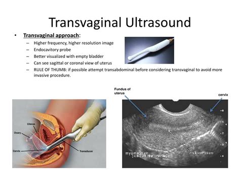 PPT - Ultrasound Basics in Obstetrics PowerPoint Presentation, free ...