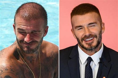 David Beckham shows off new thicker locks amid 'secret hair transplant ...