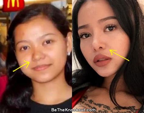 Bella Poarch Plastic Surgery Comparison Photos