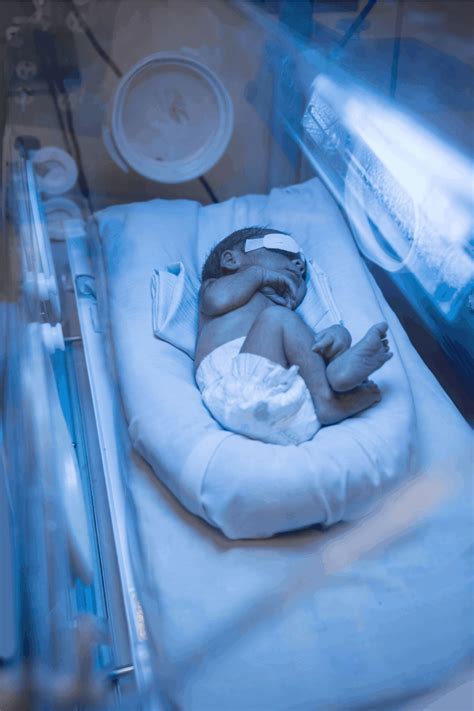 Newborn Baby Jaundice In Newborns: Why It Happens And How It Is Treated - dosamigasiguales