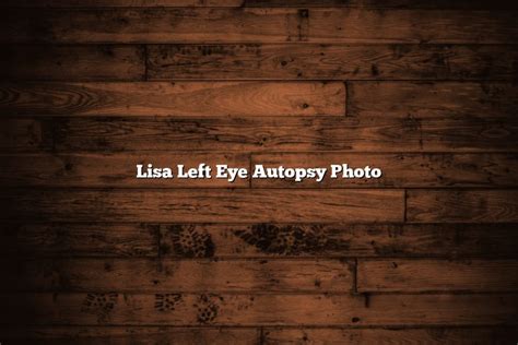 Lisa Left Eye Autopsy Photo - December 2024 - Tomaswhitehouse.com