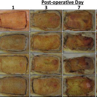 Representative images of partial-thickness burn wounds inoculated with ...