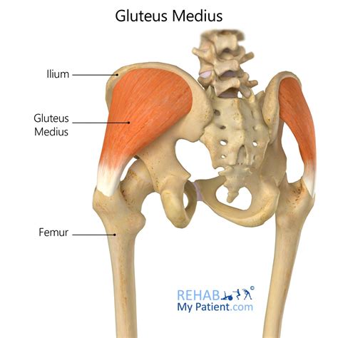 IM Injection Gluteus Medius