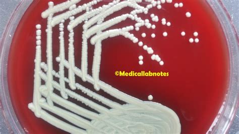 Corynebacterium diphtheriae: Introduction, Morphology, Pathogen