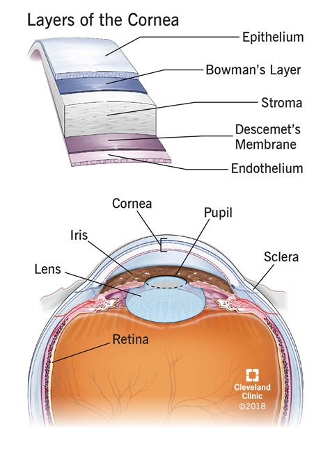 Risk Factors And Precautions For Cornea Transplant - Ask The Nurse Expert