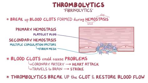 Thrombolytics: Video, Anatomy, Definition & Function | Osmosis