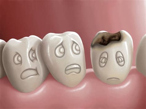 Steps to remineralize your teeth and arrest the early signs of decay