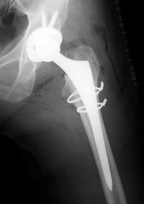 Medical Apparatus Imaging Guide: joint arthroplasty