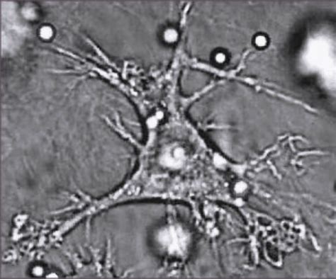 Dendritic cell - wikidoc