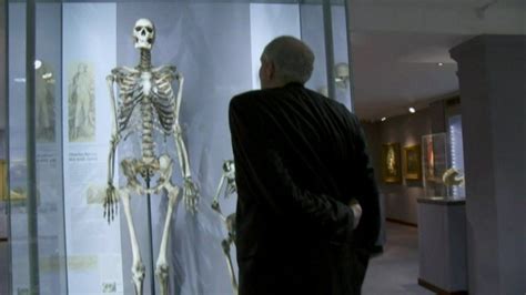 The Irish Giant: Charles Byrne's skeleton removed from display - BBC News