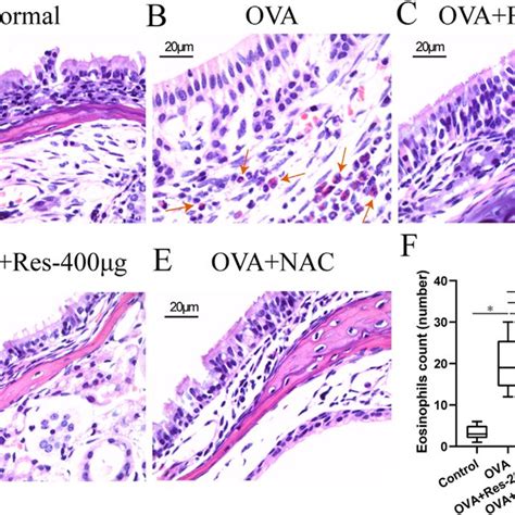 (A-F) HE staining for eosinophils in nasal tissues from normal control... | Download Scientific ...