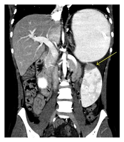 CT scan with oral and intravenous contrast. CT scanogram (a), axial CT... | Download Scientific ...