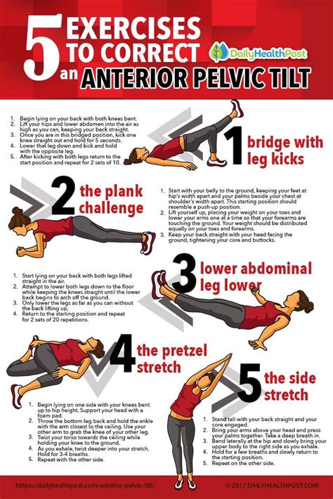 Best Exercises For Anterior Pelvic Tilt – Online degrees