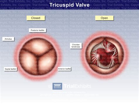 Tricuspid Valve - TrialQuest Inc.