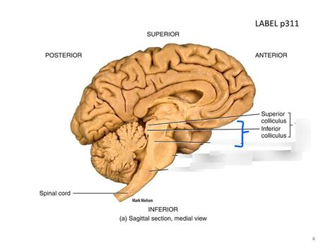 Brain Stem Diagram | Quizlet