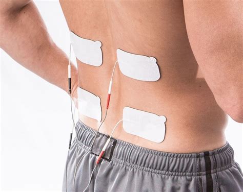 Tens Unit Placement Chart For Sciatica