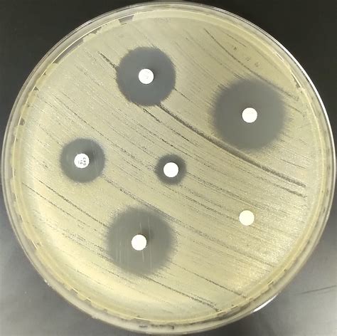 Kirby-Bauer Disc Test | Kirby-Bauer Antimicrobial Susceptibi… | Flickr