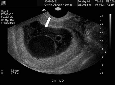 Pin on OB/Gyn Ultrasound 101 Mod 2