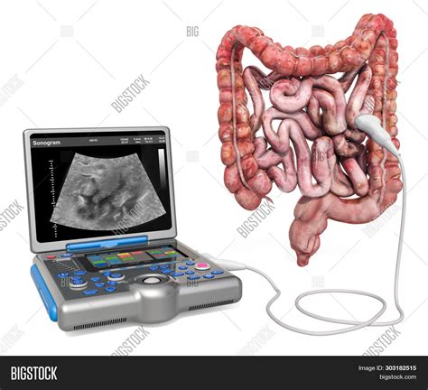 Digestive Ultrasounds Image & Photo (Free Trial) | Bigstock