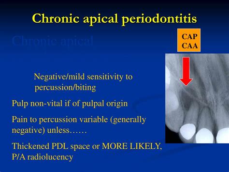 Apical Periodontitis Vs Apical Abscess