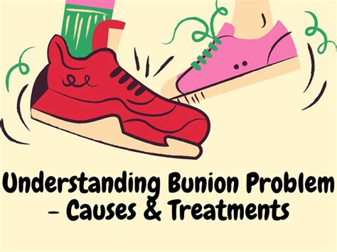 Understanding Bunion Problem - Causes & Treatments - Luxury Stnd