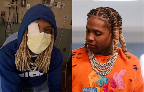 Lil Durk Announces Hiatus After Eye Injury From Explosion On Stage ...