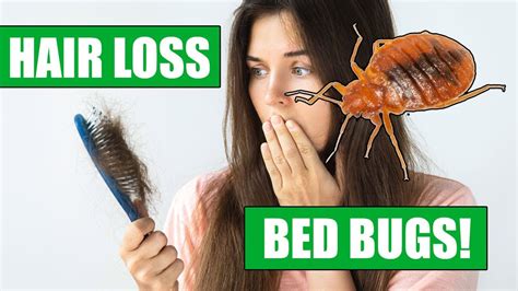 Do Bed Bugs cause Hair Loss? - A Story of Bed Bugs and Hair Loss - What to do - YouTube