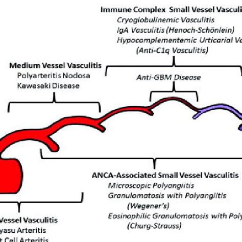 (PDF) ANCA Vasculitis in Algeria