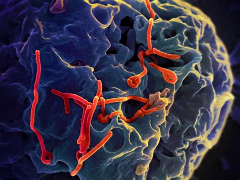 This scanning electron micrograph shows Ebola virus budding from the ...