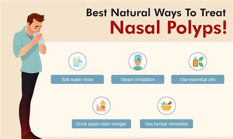 Risk Factors And Precautions For Nasal Polyps - Ask The Nurse Expert