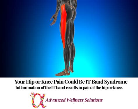 IT Band Syndrome Causes Hip or Knee Pain - Advanced Wellness Solutions