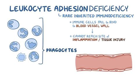 Deficiencia de adhesión leucocitaria: Vídeo | Osmosis